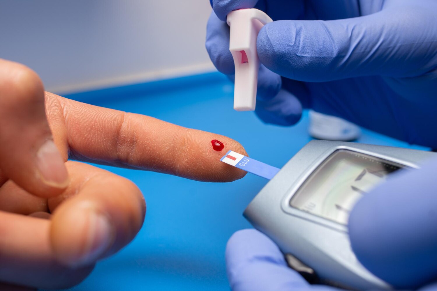 Diabetic Kidney Disease Management